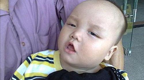 吃瓜以后舌头疼,揭秘夏日饮食健康陷阱